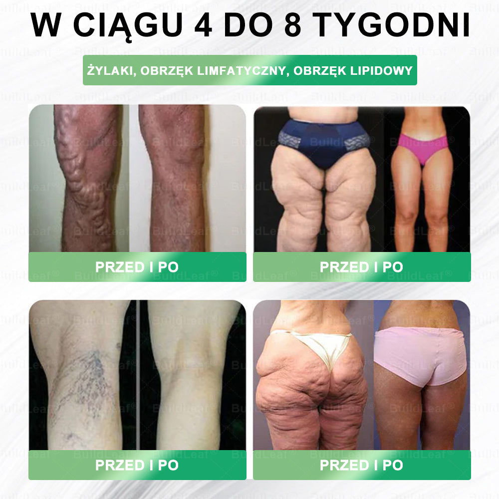 🍃Oficjalny sklep Polska | BuildLeaf® GLP-1 8-w-1 Fit & Vital Rozwiązanie (Jednorazowe dziennie, widoczne zmiany w ciągu 7 dni) ✅ Otyłość, zdrowie sercowo-naczyniowe, cukrzyca, bezdech senny, zdrowie jelit, problemy ze stawami i inne.